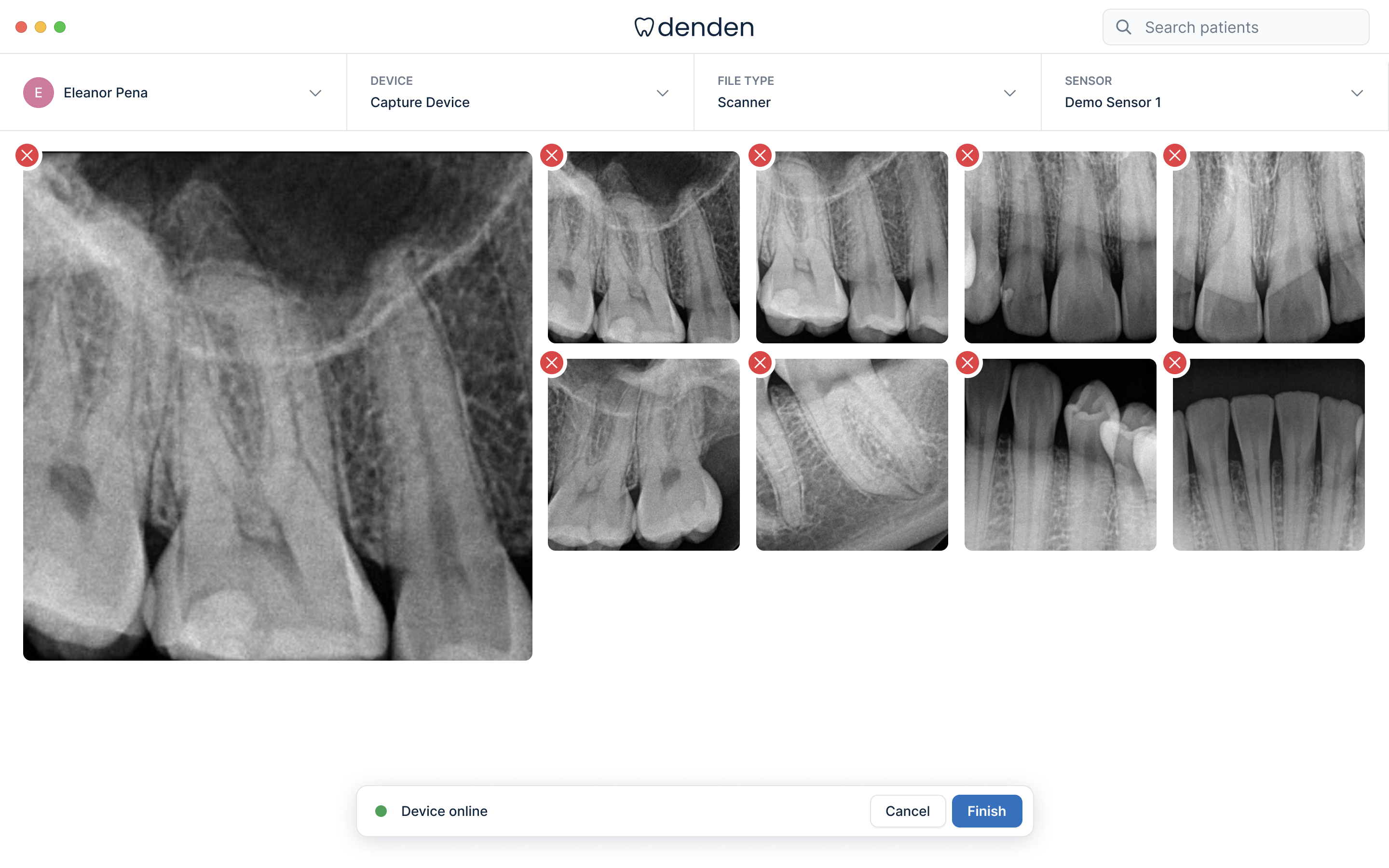 Dental Images